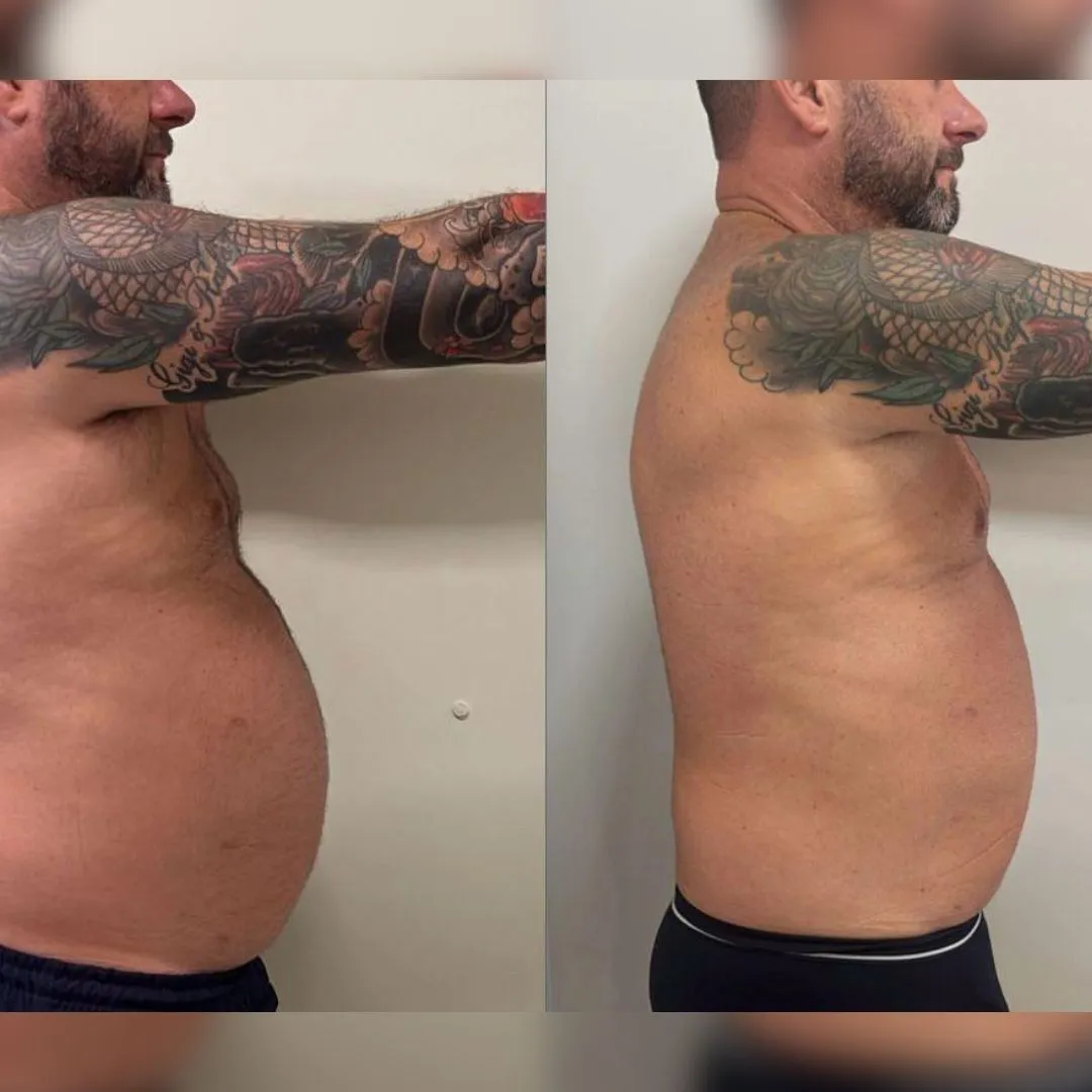 ATUALIZAÇÃO ANTES E DEPOIS (3)