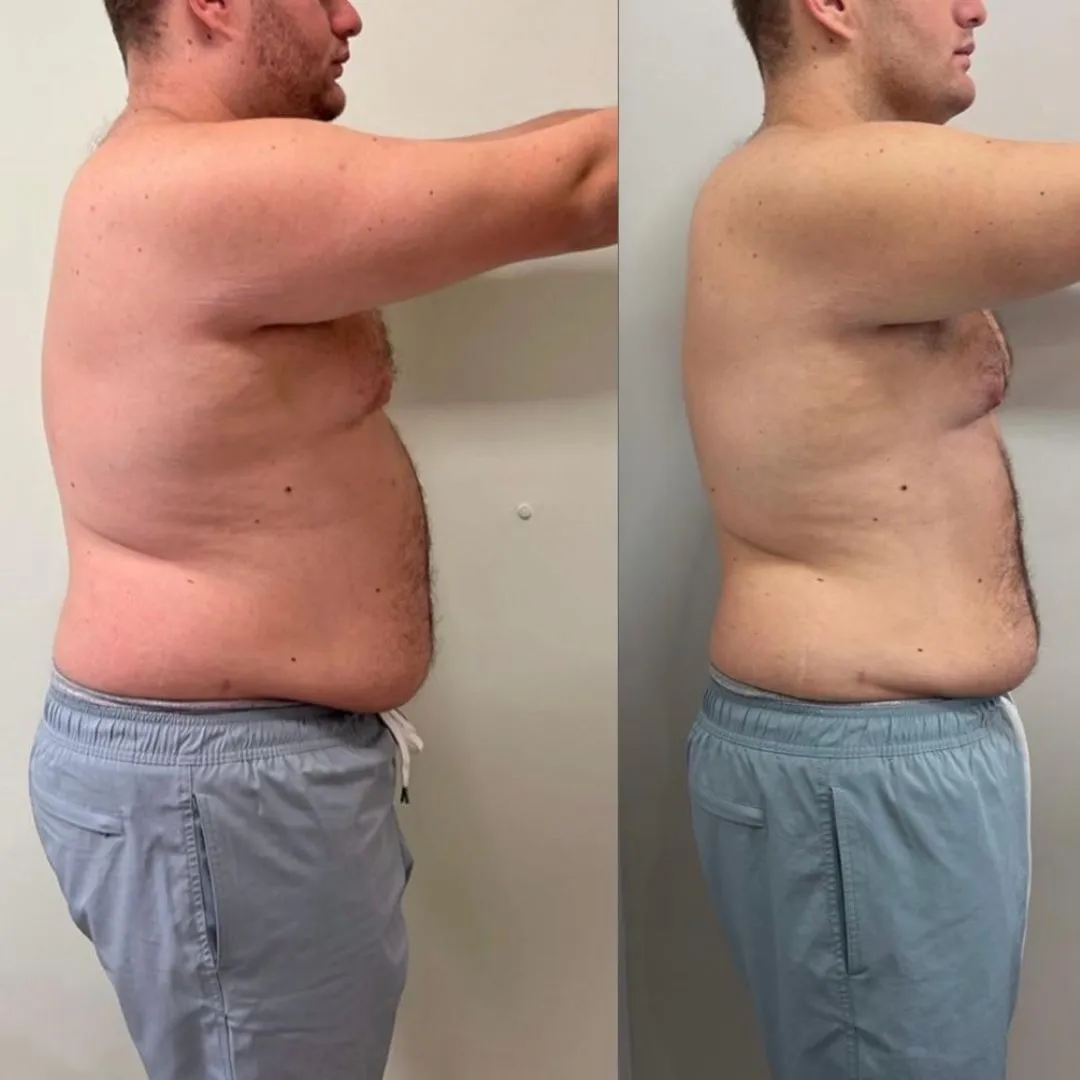 ATUALIZAÇÃO ANTES E DEPOIS (5)