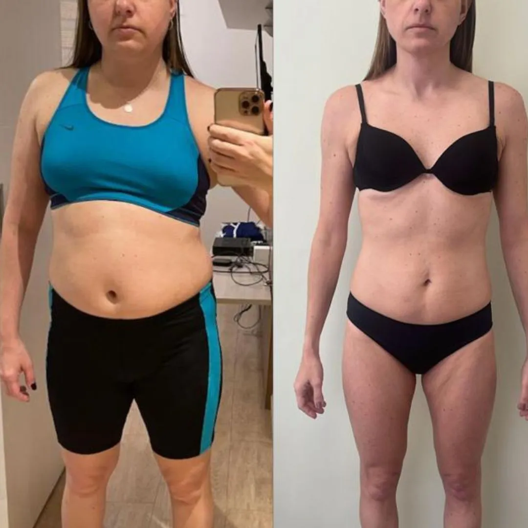 ATUALIZAÇÃO ANTES E DEPOIS (6)
