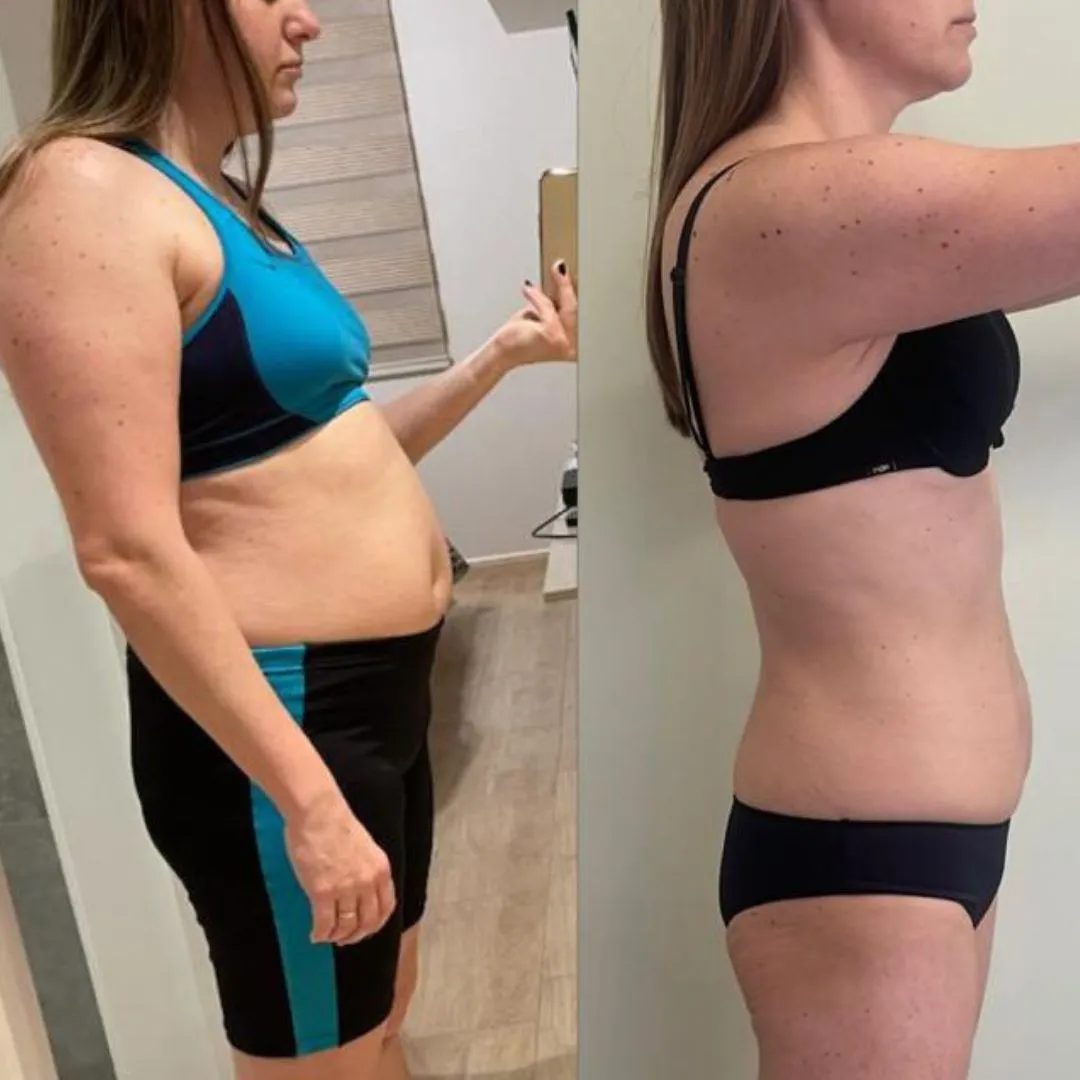 ATUALIZAÇÃO ANTES E DEPOIS (7)