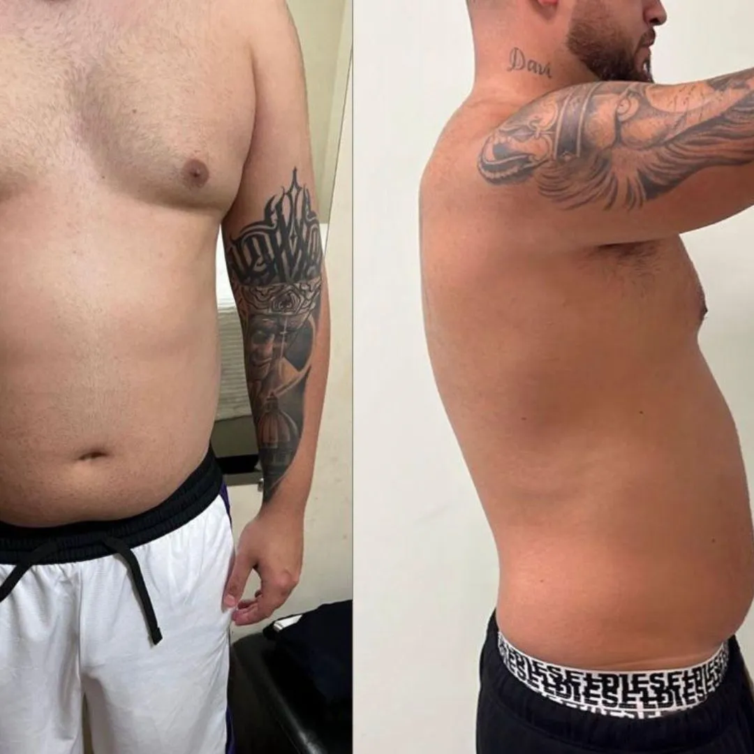 ATUALIZAÇÃO ANTES E DEPOIS (8)